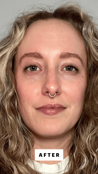 McGrath after applying the Ncessaire The Scalp Serum